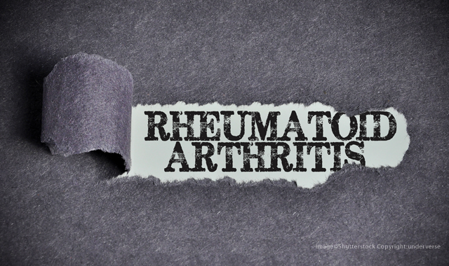 Researchers find a link between periodontal disease and rheumatoid arthritis