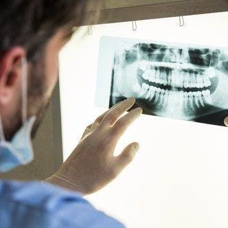 Study Suggests a Standard System for Tooth Wear Evaluation is Needed