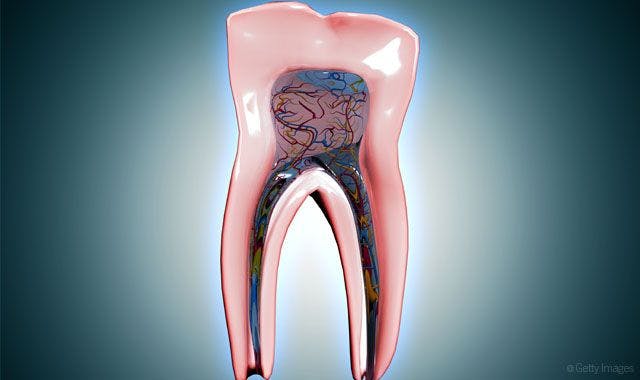 Study finds nanodiamonds might prevent tooth loss after root canals