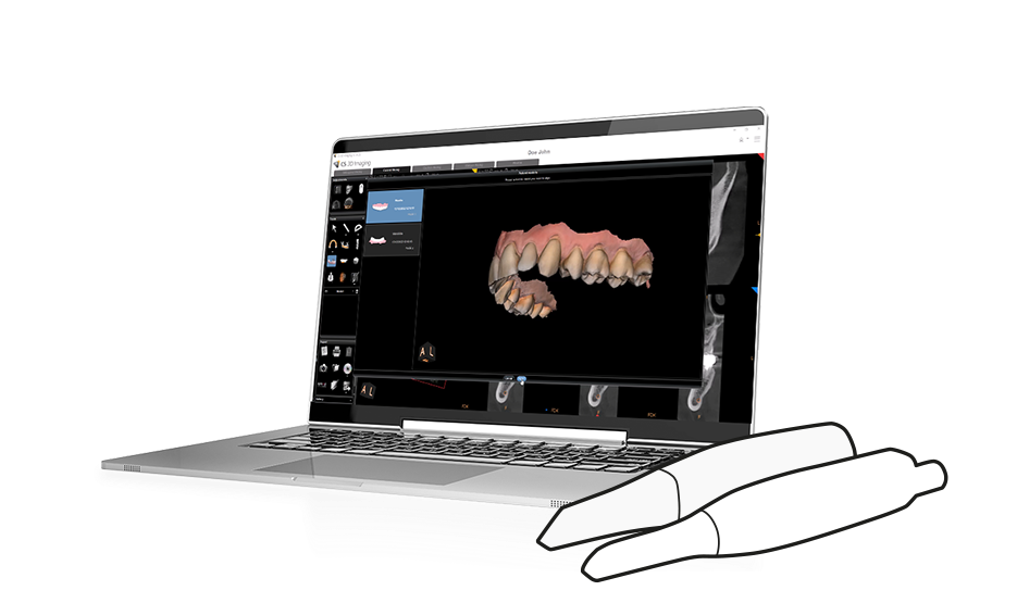 Carestream Dental’s IO Scanner Link Provides More Options, Easier Access to Intraoral Scans