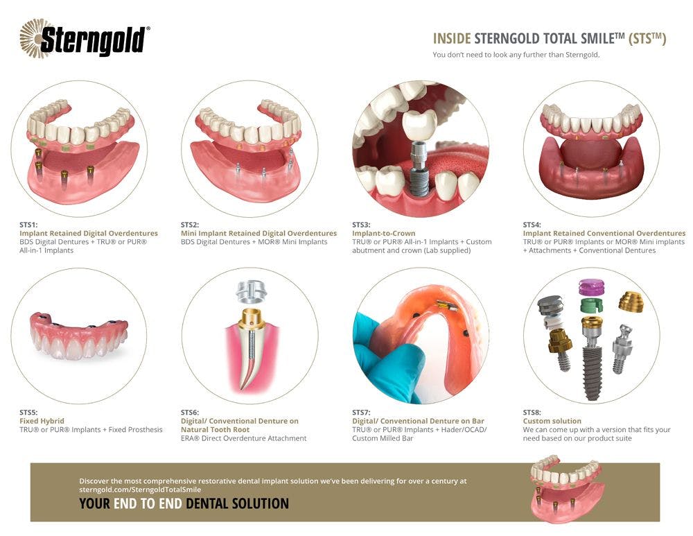 Sterngold Dental Reveals Sterngold Total Smile