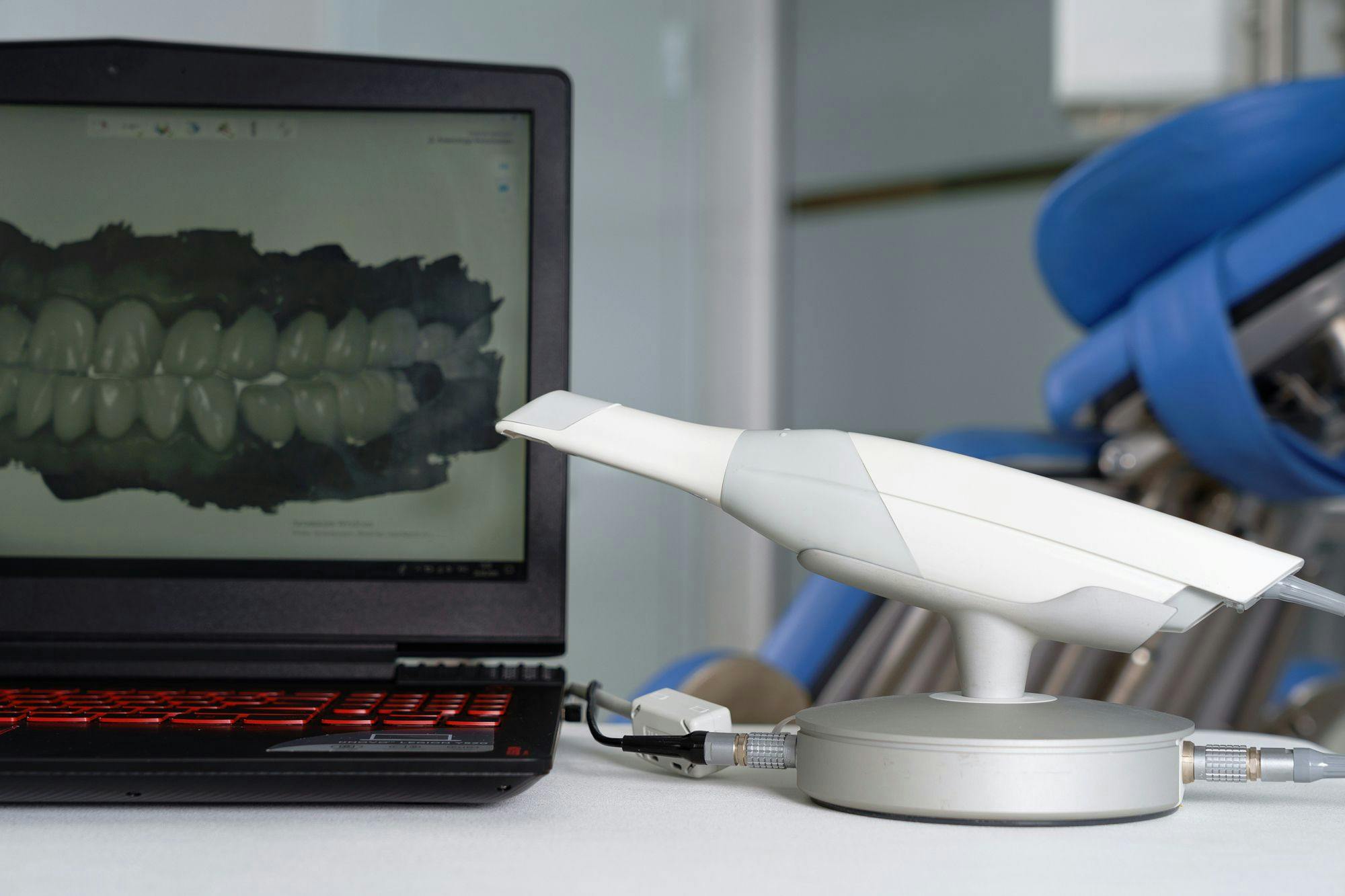 Understanding the Three Most Common Imaging Principles Used By Intraoral Scanners. Photo courtesy of Dental Pro Content/stock.adobe.com. 