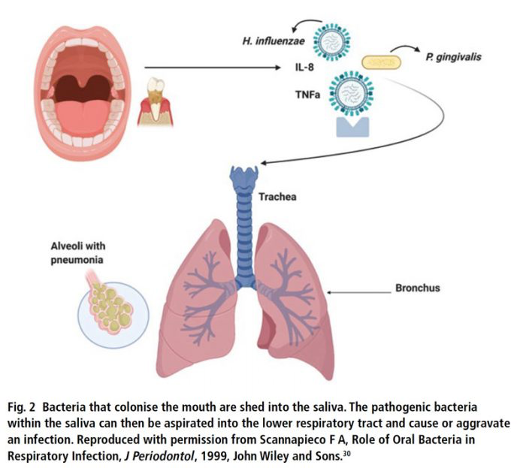 How bacteria moves from the oral cavity to the lungs