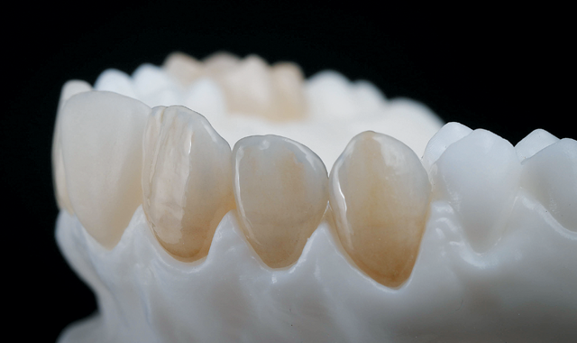 What digital materials mean for dentistry