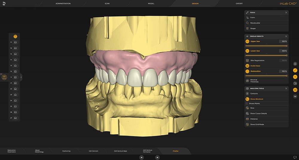 Dentsply Sirona’s New inLab Software 22.0 Integrates CEREC Primemill Into Streamlined Workflows
