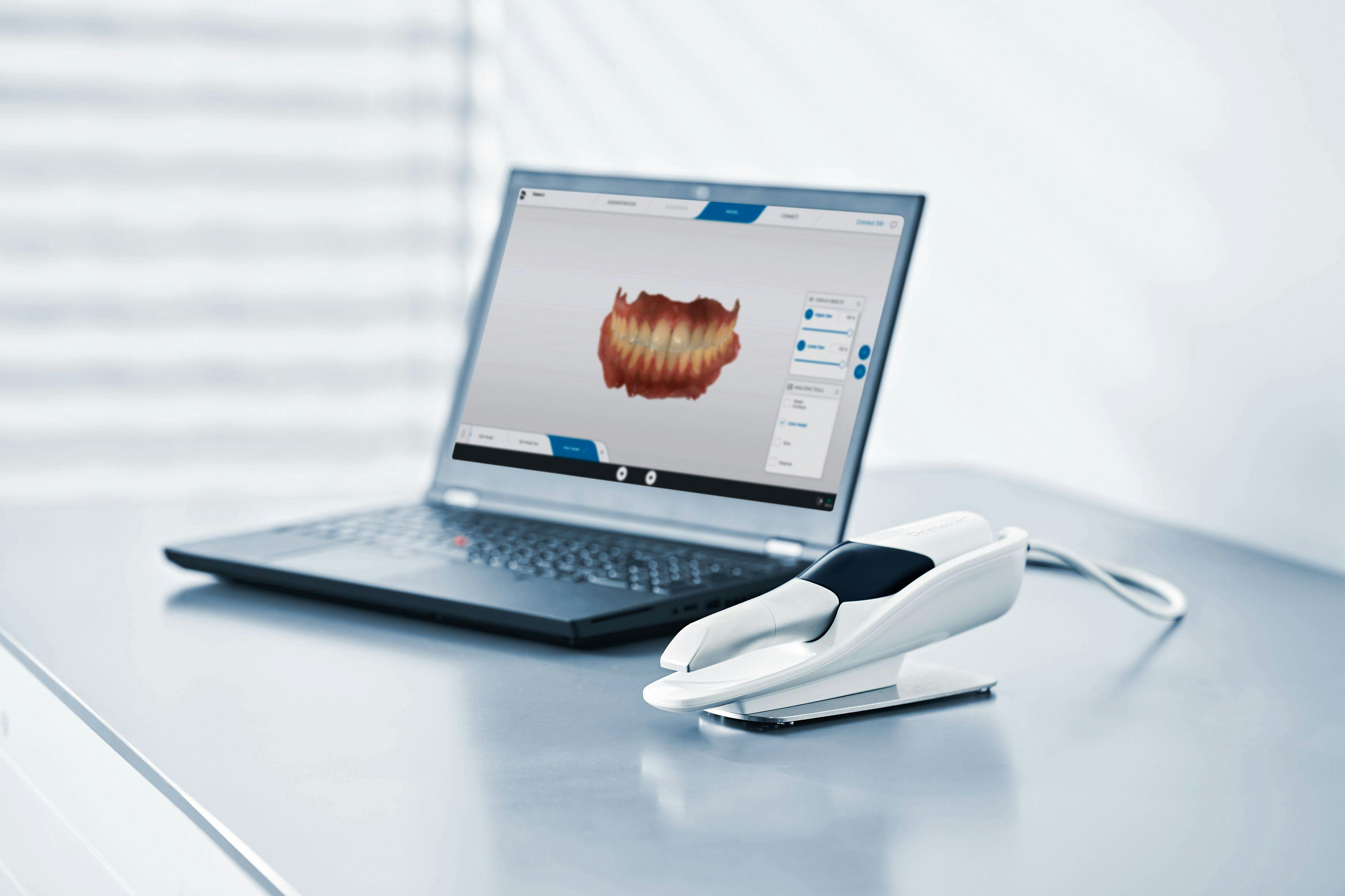 Primescan Connect intraoral scanning solution from Dentsply Sirona | Image Credit: © Dentsply Sirona