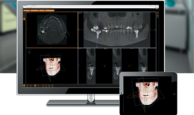 The reinvention of dental imaging software