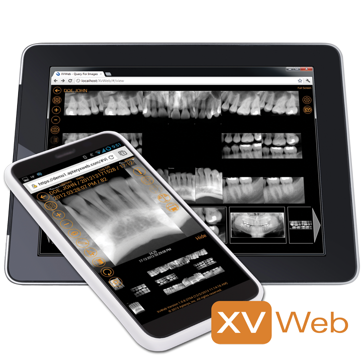 Apteryx Imaging’s XVWeb cloud-based imaging software.
