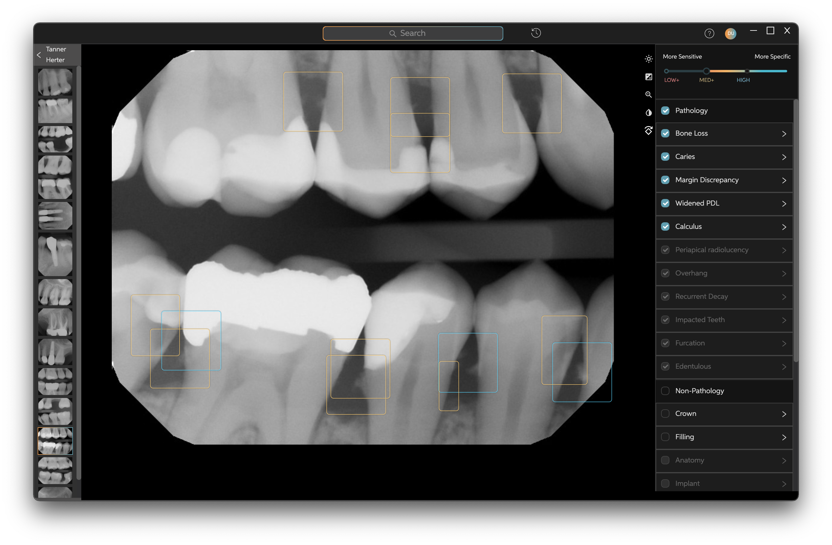 Dental Artificial Intelligence Company Pearl Granted Patent for Radiology Technology