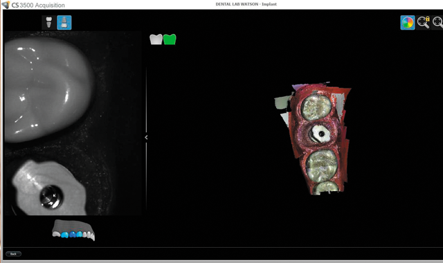 Screenshot image of scan progress with Carestream Dental's CS 3500