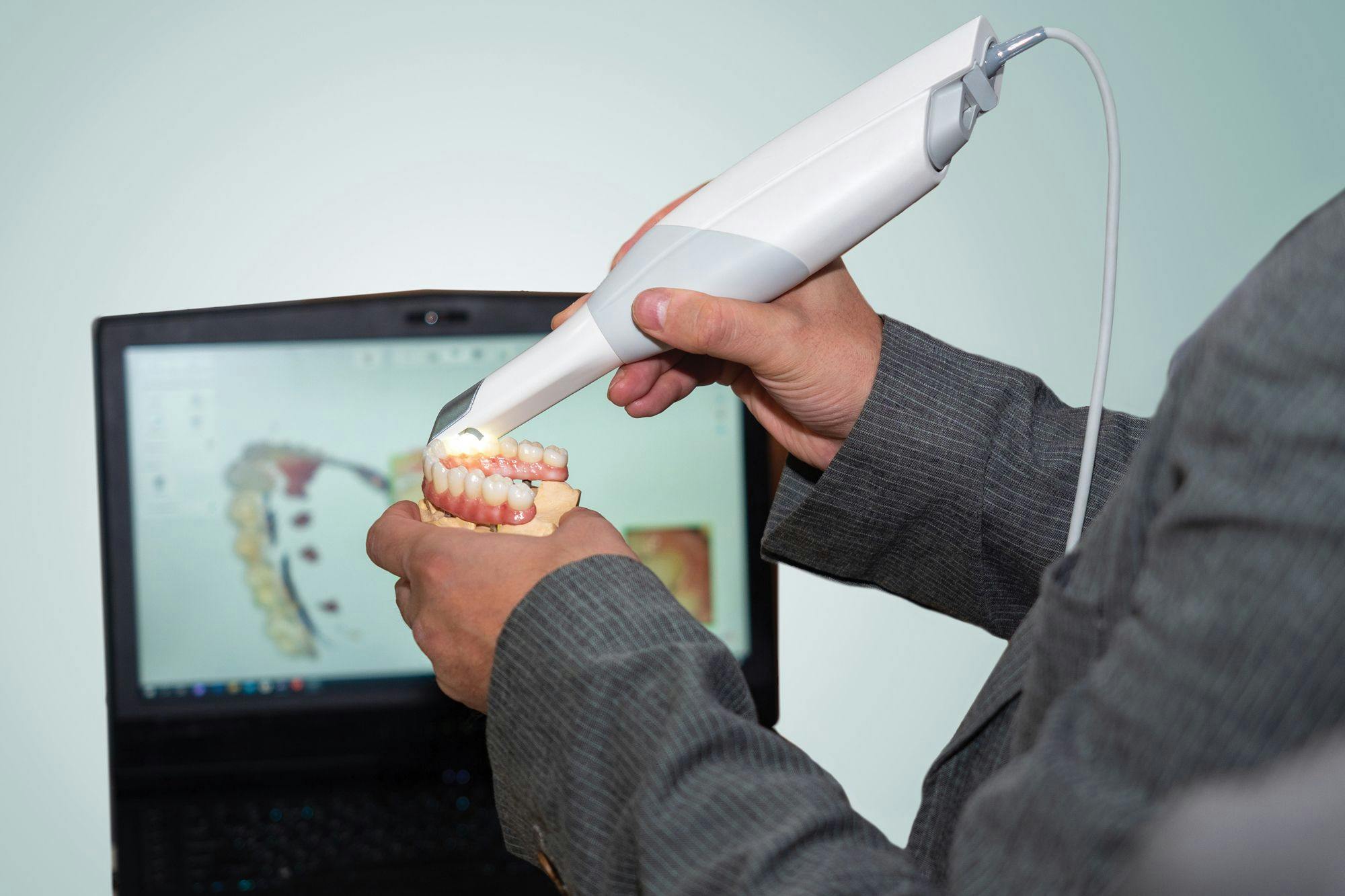 The Best Intraoral Accuracy: Intraoral Scanner Product Roundup