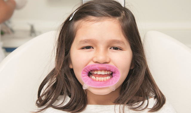 OptraGate lip and cheek retractor now available for children in two new colors