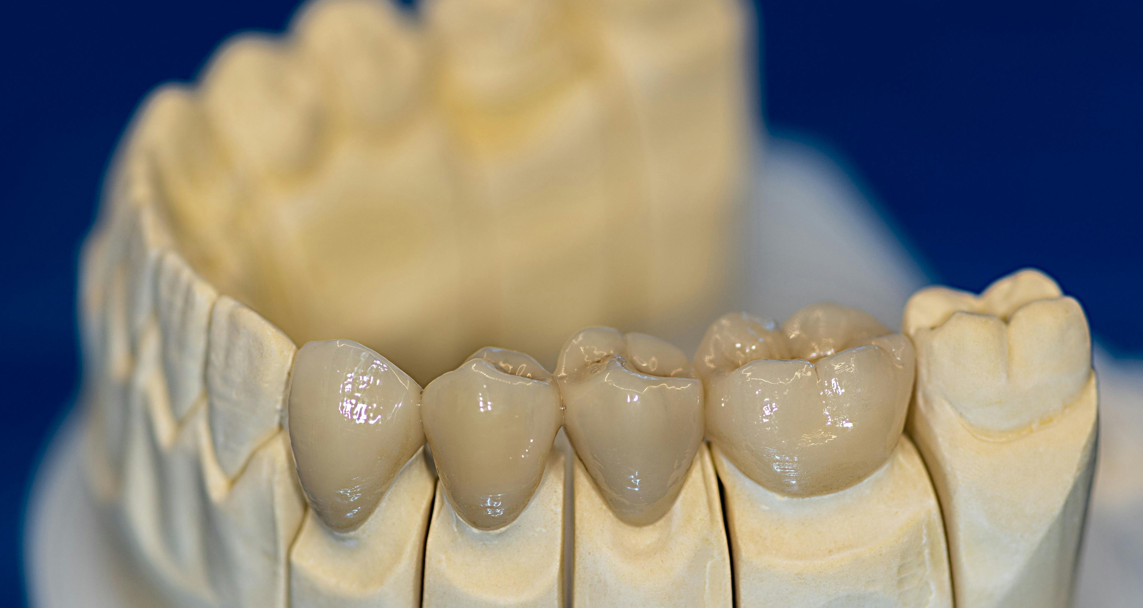 Material Options Help Digital Dentistry Excel