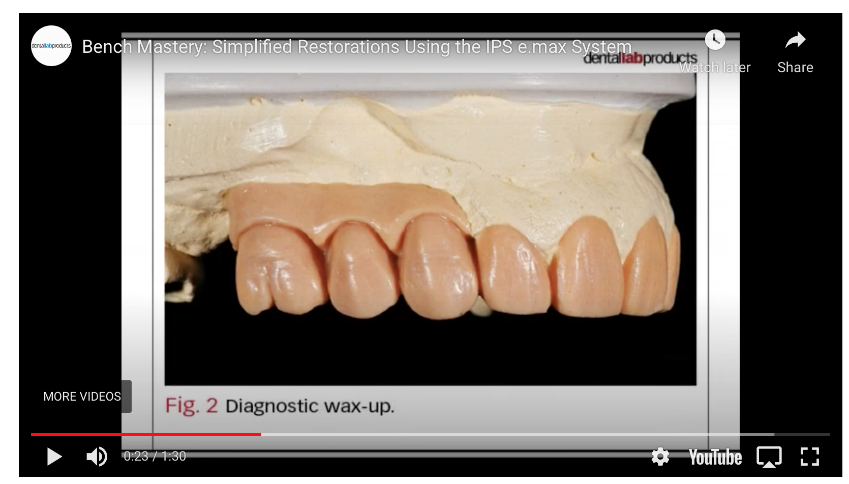 How to use IPS e.max for simpler restorations [VIDEO]