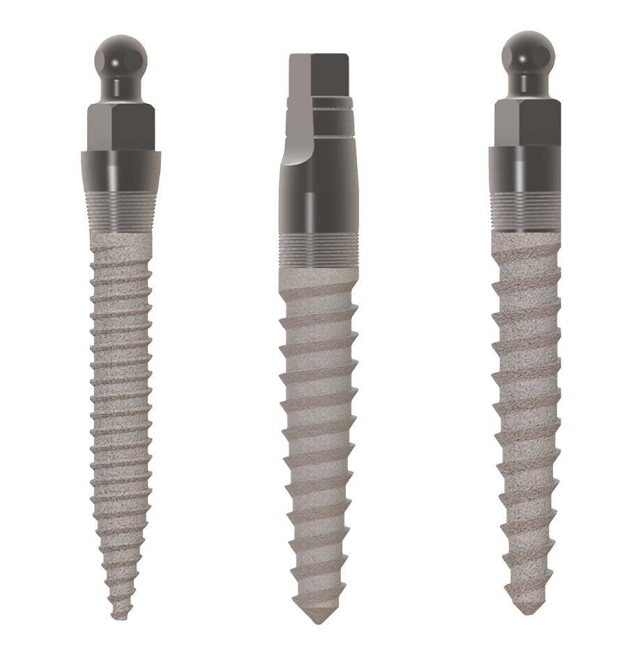 Sponsored Content: Sterngold Dental's MOR Mini Implants