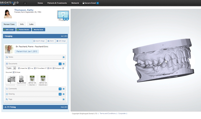 New Space Maintainers exclusive Digital Orthodontics Records Package saves time and space