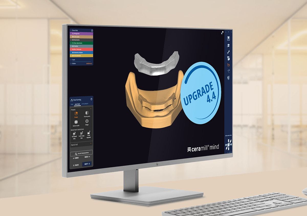 The latest Upgrade 4.4 of the intelligent Ceramill software from Amann Girrbach provides users in the laboratory and dental practice with a broader range of indications, simpler workflows, and high process safety.