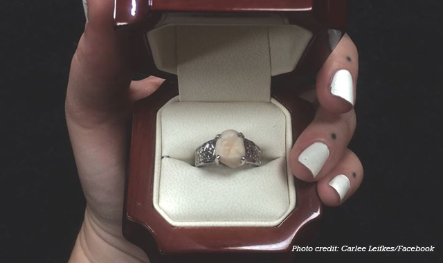Wise move? Man proposes to girlfriend with ring made from wisdom tooth