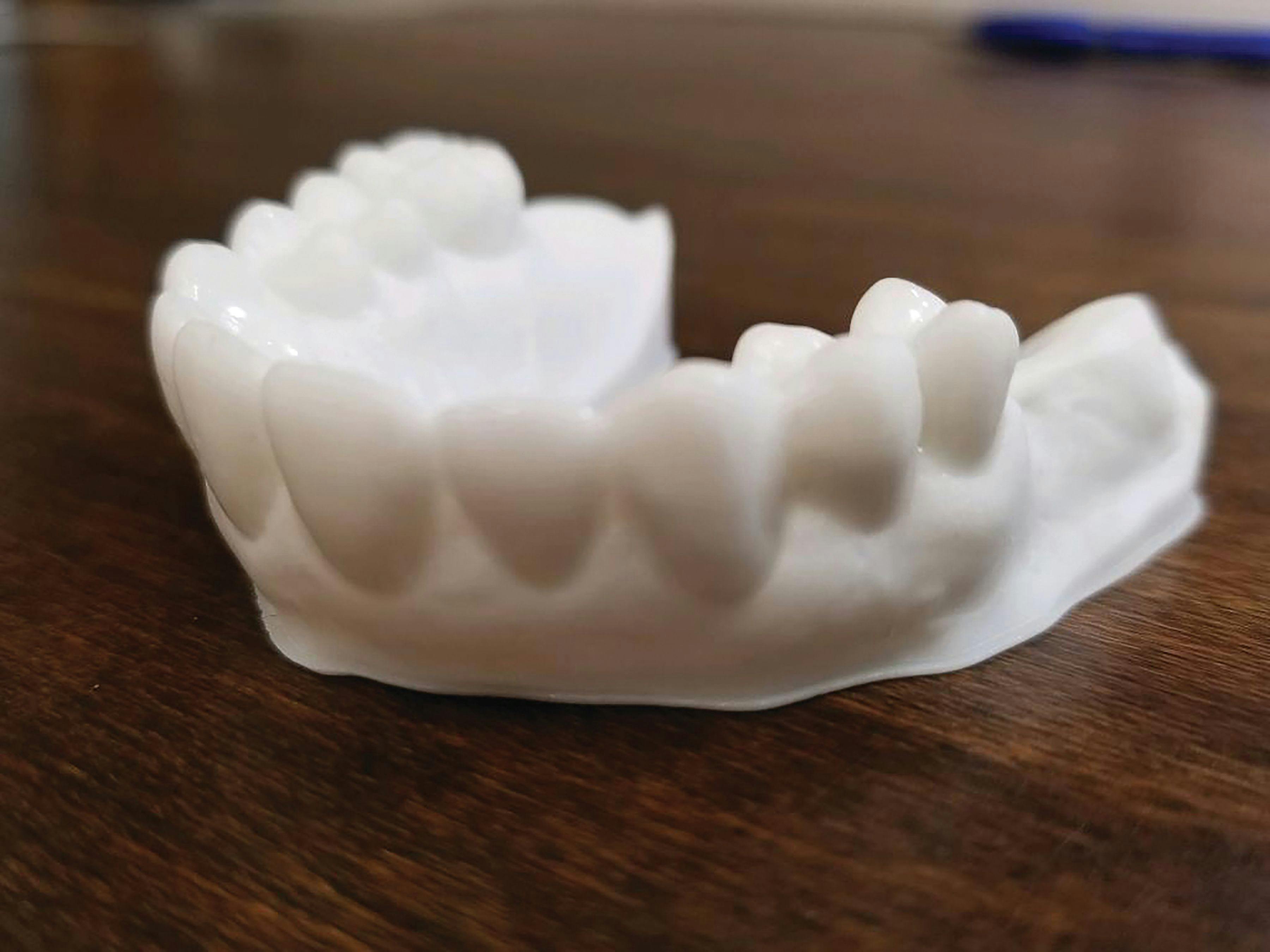 Vega’s Dental Laboratory Solutions scans, designs,  and prints a large percentage  of its total production.  A model is shown here.