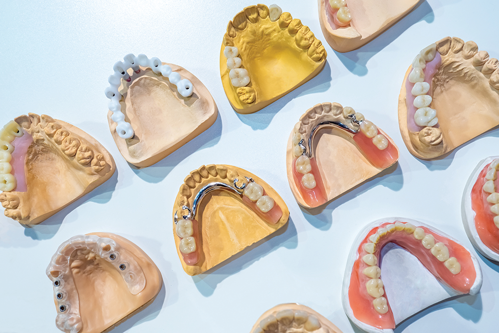 A range of dental restorations created in a dental lab –  Grispb / stock.adobe.com
