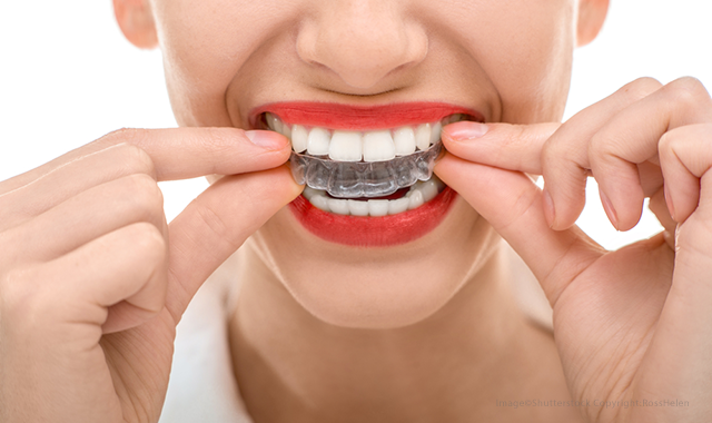 4 reasons why more adults are considering orthodontic treatment
