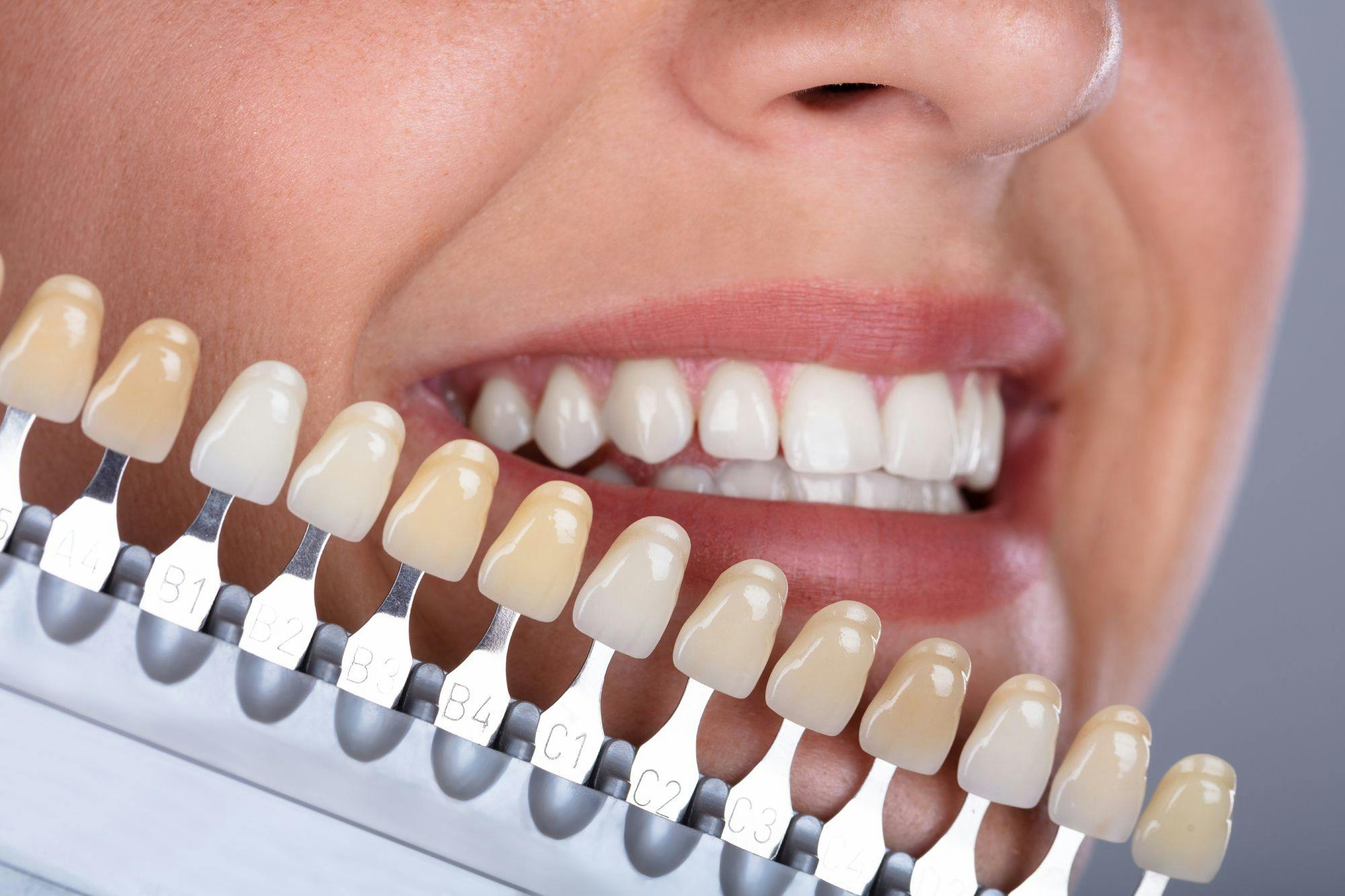 The Science Behind How Light Affects Color When Shade Matching Teeth. Photo courtesy of Andrey Popov/stock.adobe.com. 