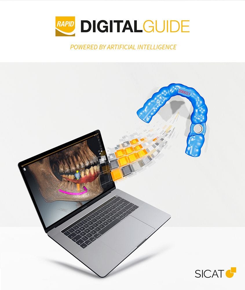 SICAT’s RAPID DIGITALGUIDE Solution Delivers Ready-to-Print Surgical Guide Design