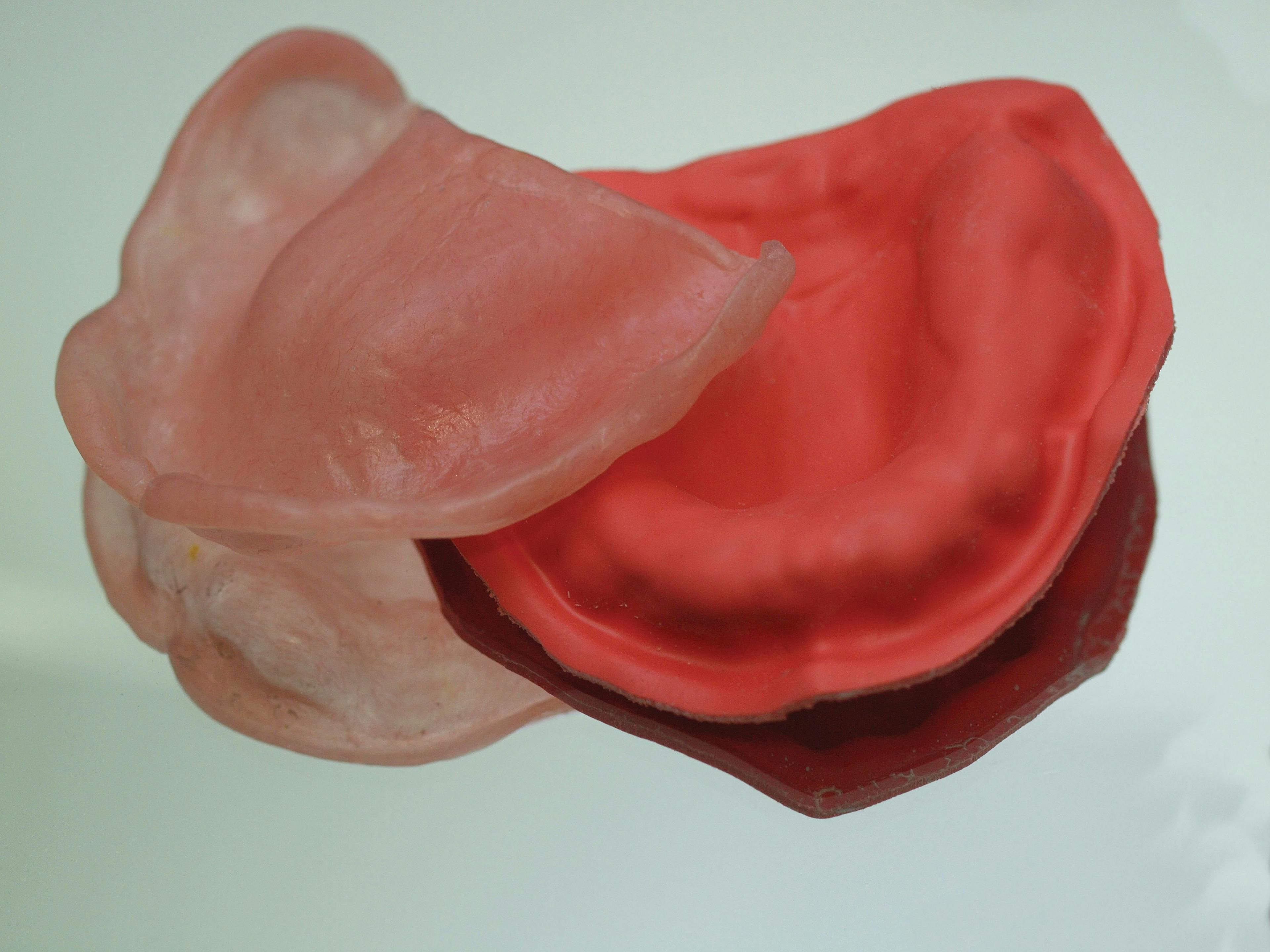 How to Achieve the Completed Denture Base