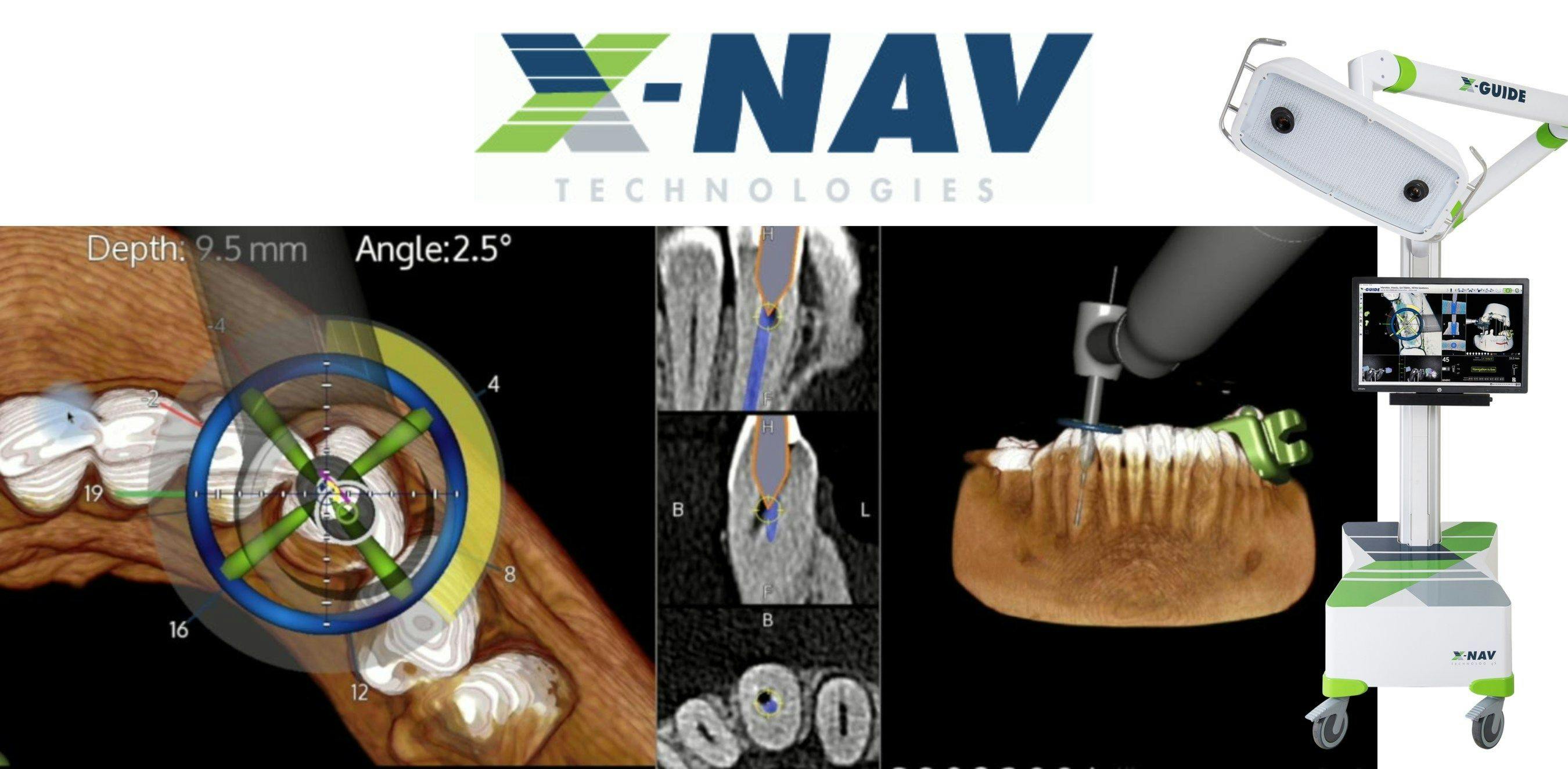 X-Nav Technologies' X-Guide Surgical Navigation 