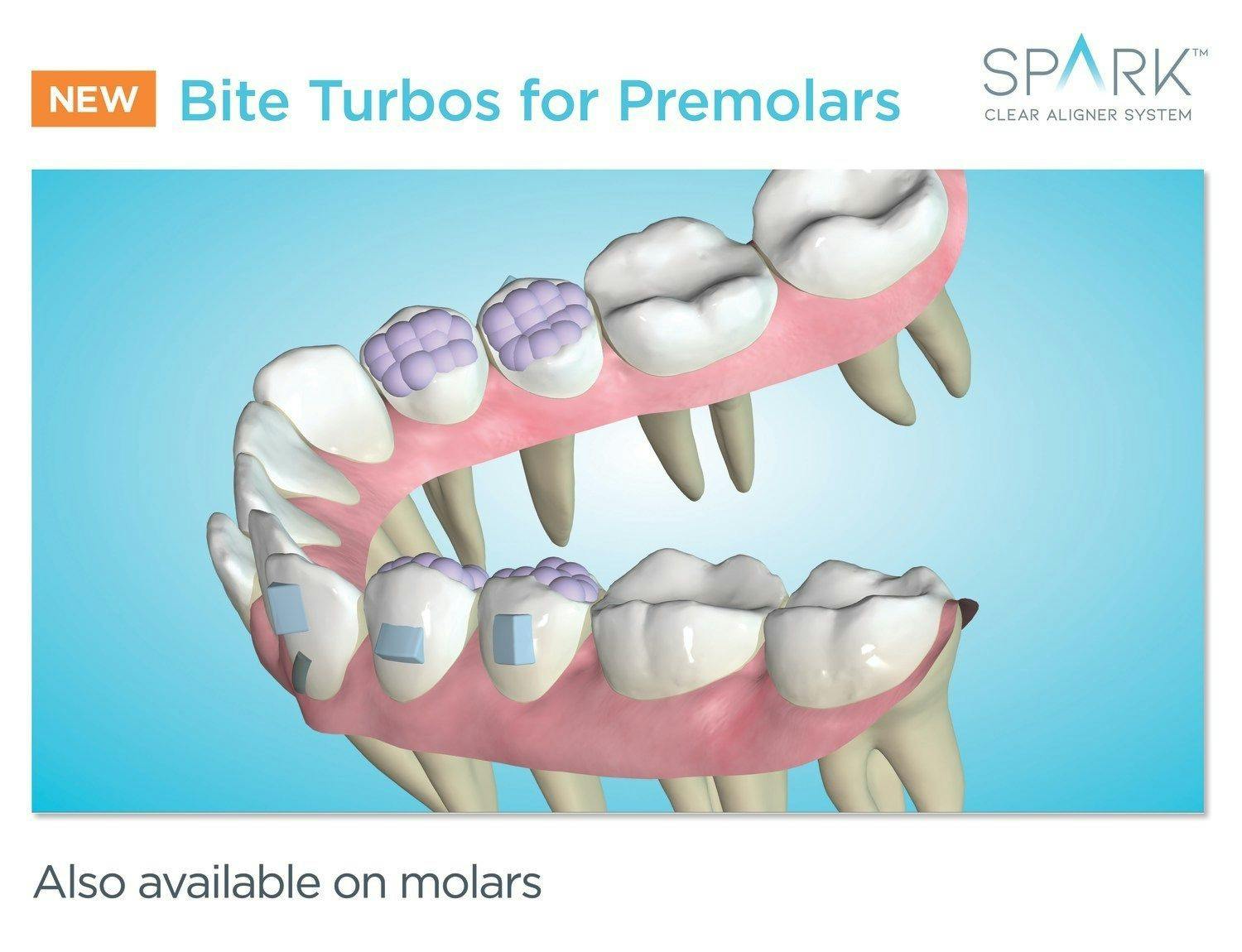 Spark Aligners Announce New Release 12