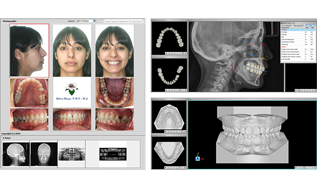 InnSoft introduces Ortho Share 3D software