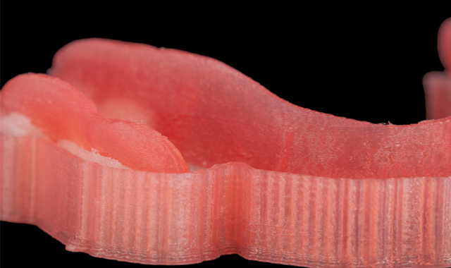 3D printed denture before post-processing