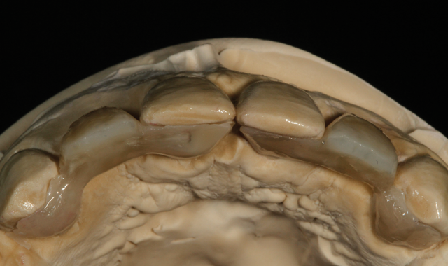 Occlusion view-shape and contour 
