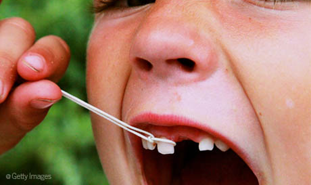 The 9 craziest ways people have pulled teeth